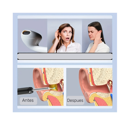 LIMPIADOR DE OIDOCAM PRO®